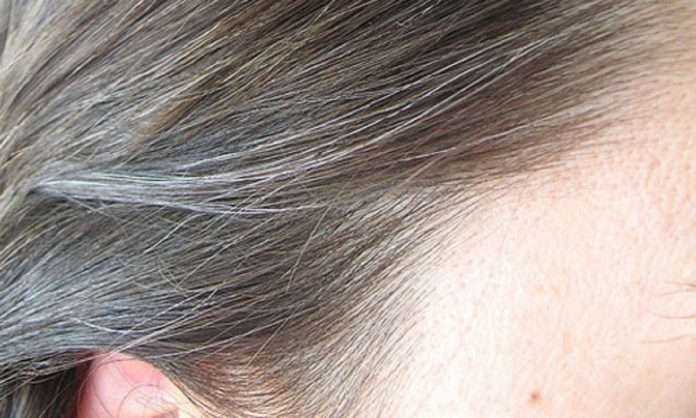 how to white hair problem solution
