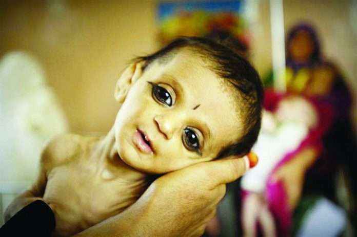508 babies died in 9 months in melghat