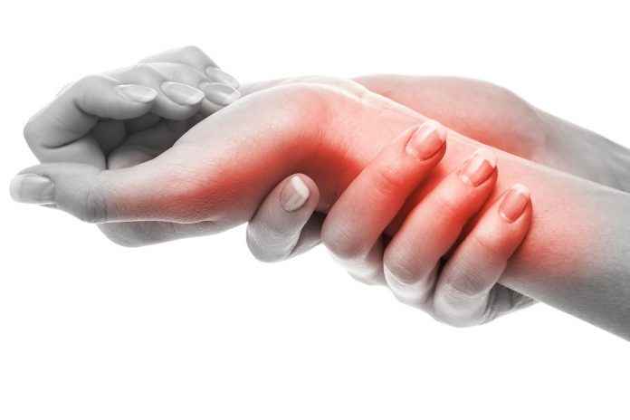 rheumatoid arthritis treatment guidelines