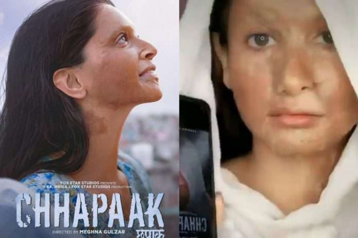 Deepika Padukone throws TikTok challenge on her Chhapaak acid survivor ‘look’. Disgusting, says Internet