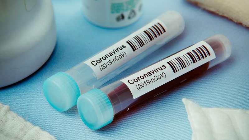 Coronavirus: भारतात प्रत्येक २४ टेस्टमागे एक कोरोना पॉझिटिव्ह आढळतोय