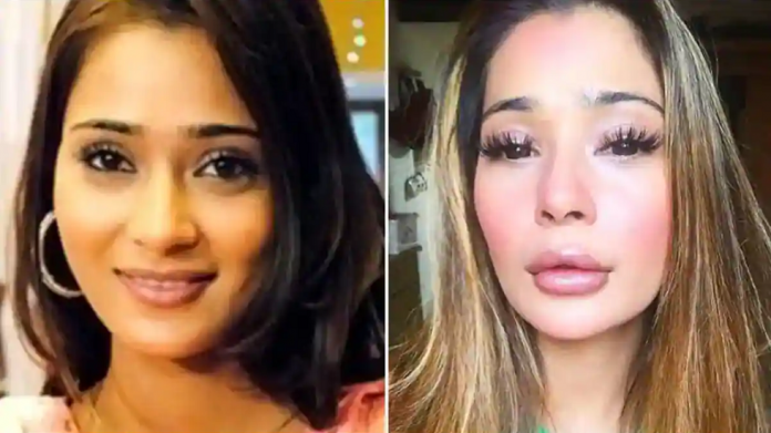 sara khan talk about lip surgery