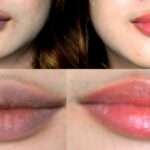 home remedies for dark lips