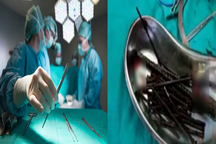 iron stuff left in stomach during surgery in unnao at uttar pradesh