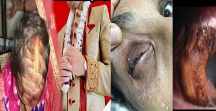 girlfriend got angry as the boyfriend got married faviquic poured into the bride's eye