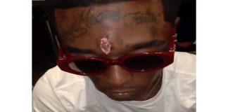 rapper from america has pierced the center of his head with diamond