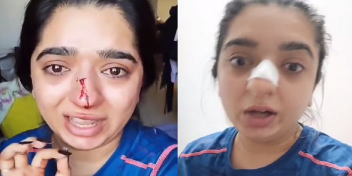 Zomato delivery boy hit the woman in nose after canceling the Zomato order