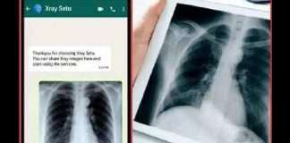 Positive India X-Ray Setu on WhatsApp can detect coronavirus without RT-PCR test; here's how to use it