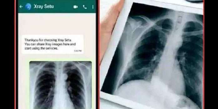 Positive India X-Ray Setu on WhatsApp can detect coronavirus without RT-PCR test; here's how to use it