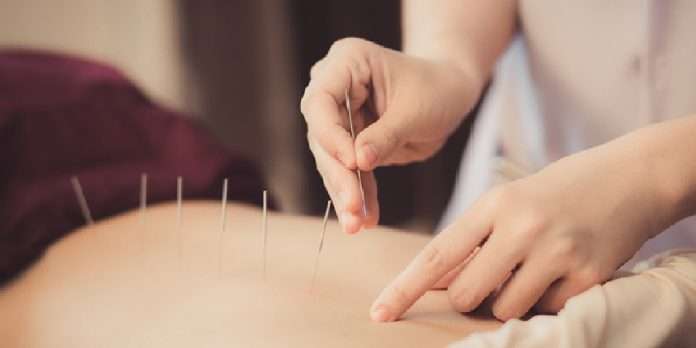 acupuncture medicines effective in the treatment of COVID-19 related symptoms