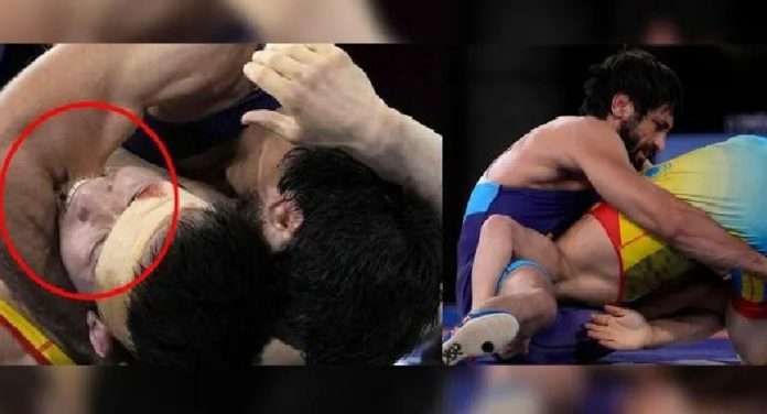 kazakistan wrestler takes bites on arms of Ravi Dahiya