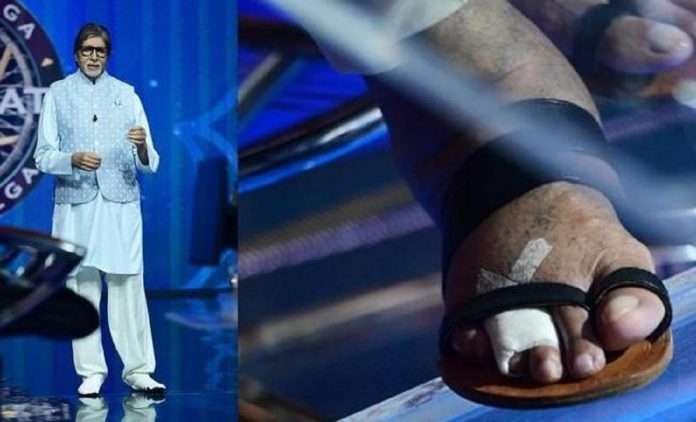KBC 13: Amitabh Bachchan shares pics of his fractured toe, fancy ‘sock-like’ shoes from sets