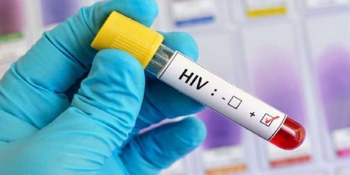 united kingdom a second patient cured from hiv virus