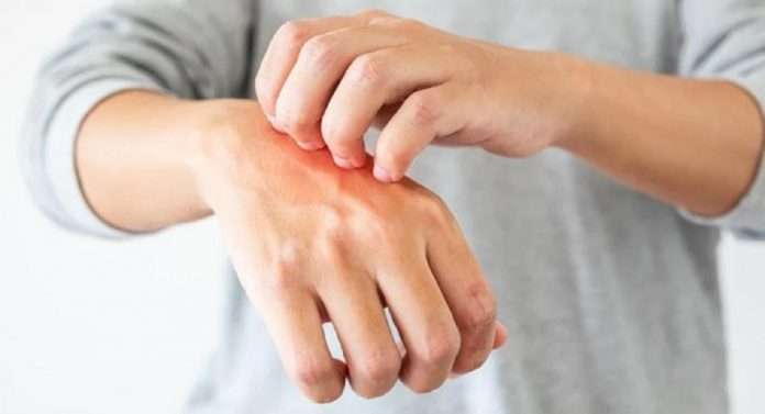 covid 19 virus omicron symptoms in india skin problem precaution expert opinion