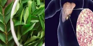 Fatty Liver | Curry leaves are good for fatty liver; Learn the benefits