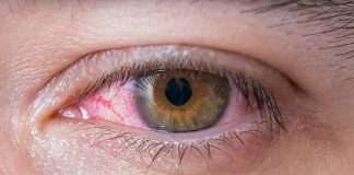 Diabetes warning The signs in your eyes that could mean you have the disease