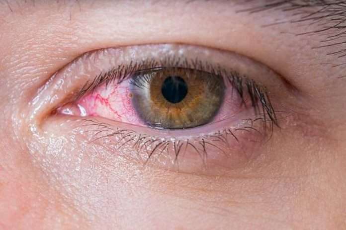 Diabetes warning The signs in your eyes that could mean you have the disease